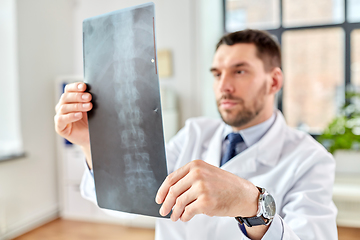 Image showing male doctor with x-ray of spine at hospital