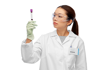 Image showing asian female doctor holding beaker with blood test