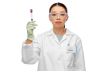 Image showing asian female doctor holding beaker with blood test