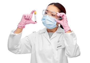 Image showing asian female doctor holding beaker with blood test