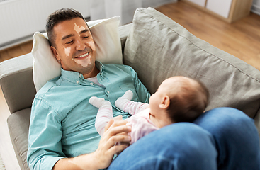 Image showing middle aged father having vitiligo with baby