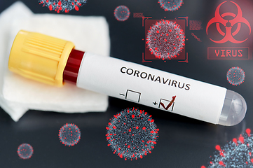 Image showing beaker with coronavirus blood test