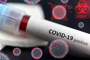 Image showing beaker with coronavirus blood test over virions