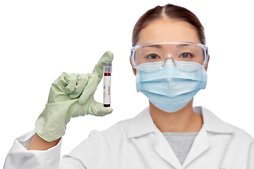 Image showing asian female doctor holding beaker with blood test