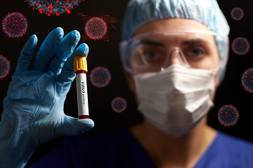 Image showing doctor holding beaker with virus blood test