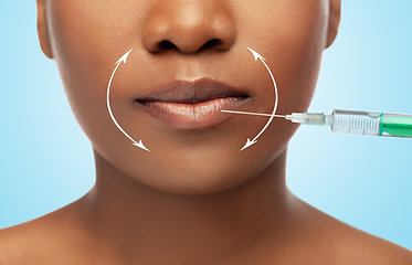 Image showing lips of african american woman and syringe