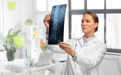 Image showing female doctor with x-ray of spine at hospital