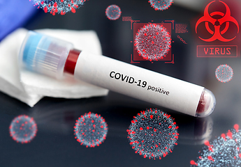 Image showing beaker with coronavirus blood test over virions