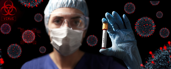 Image showing doctor holding beaker with virus blood test