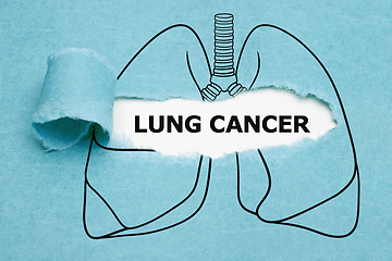 Image showing Lung Cancer Drawn Concept