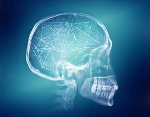 Image showing Human skull X-ray image. Artificial intelligence concept