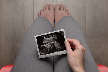 Image showing Pregnant woman sitting on chair - top view