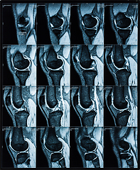 Image showing Magnetic resonance tomography (MRT) images of knee