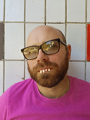 Image showing Bald man in eyeglasses with ugly teeth