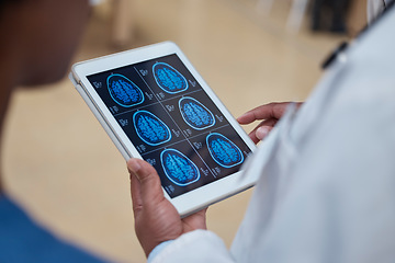 Image showing Doctor, hands and tablet with brain scan in healthcare examination, surgery or anatomy research at hospital. Hand of male person or medical professional with technology of head x ray exam at clinic