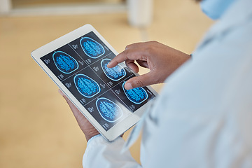 Image showing Brain scan, xray and closeup of a doctor with a tablet for a neurology consultation or surgery. Healthcare, digital technology and hands of surgeon analyzing a mri image in medical hospital or clinic