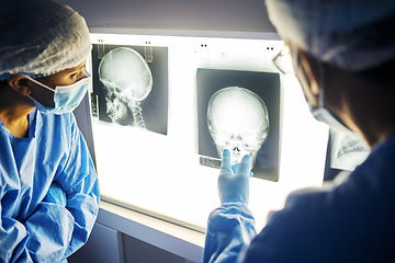 Image showing Skull x ray, screen and doctor with analysis of scan, healthcare and surgery with medical team and neurology. Radiology, assessment and plan with people in hospital, surgeon and medicine with anatomy