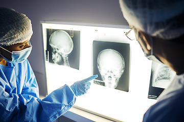 Image showing Dentist group, teeth x ray and together for analysis, study and learning in clinic for healthcare. Medic team, monitor skull and tooth growth for wellness, care and point with discussion in hospital