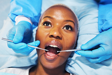 Image showing Dental surgeon, woman and tools in mouth at clinic for cavity, teeth whitening and helping hand for pain. Dentist, African patient and top view for tooth extraction, care and check for healthy smile