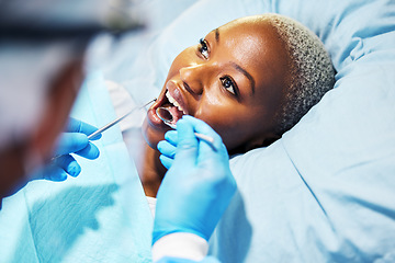 Image showing Dentist, inspection and woman with tools in mouth at clinic for cavity, teeth whitening and helping hand for pain. Dental surgeon, African patient and mirror for exam, care or check for healthy smile