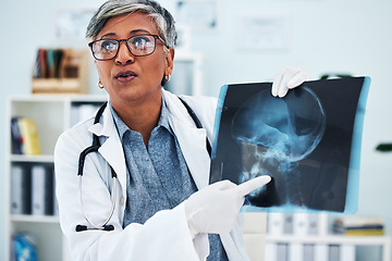 Image showing Hospital, doctor and senior woman with x ray for surgery, medical consultation and in diagnosis with patient. Healthcare, medicare and female health worker explain with head scan for injury analysis