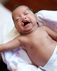 Image showing Cleft lip, baby and child birth with a portrait of a newborn crying in her crib at home. Childcare, young and infant girl kid with a medical condition laying on a blanket in her nursery in hospital