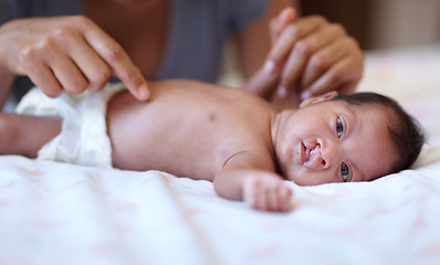 Image showing Care, portrait and a baby with a cleft palate being changed, playing and hands of a mother with love. Family, health and a newborn child with a disability and a mama or parent for childcare