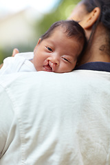 Image showing Portrait, cleft palate and baby with health, care and hug with mother, relax and bonding together. Face, mama and happy infant embrace, medical condition and family with newborn, mouth and resting