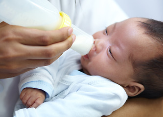 Image showing Baby with cleft lip, milk and mom feeding from bottle for nutrition, health and wellness. Formula, newborn and hand of mother feed child for development, growth or healthy diet, food or lunch at home