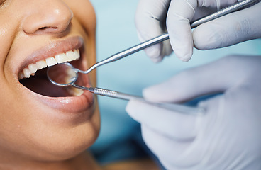 Image showing Dentist, healthcare and hands, patient mouth and medical tools, surgery and dental health. Tooth decay, orthodontics procedure and people in clinic for oral care, metal instrument and gingivitis