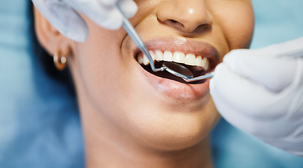 Image showing Dentist, mirror and hands, patient mouth and medical tools, surgery and dental health. Tooth decay, healthcare and people at orthodontics clinic for oral care, metal instrument and gingivitis