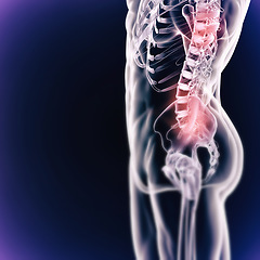 Image showing Scan, anatomy and skeleton bones of body on x ray digital background. Graphic of human person in pain, medical and research or results of xray of back injury or fractured joint or spine of a patient