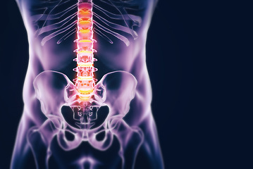 Image showing Spine, anatomy and xray for healthcare, medical or insurance in studio on a dark background to diagnose a bone condition. Surgery, physiotherapy and emergency with a skeleton scan of a patient