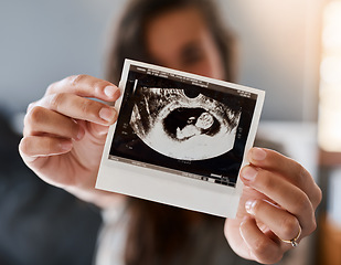 Image showing Hands, sonogram photo and closeup for woman, pregnancy and baby for health, wellness and growth. Ultrasound picture, fetus or infant development for healthcare, progress and monitor for unborn child