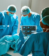 Image showing Surgery, operating room and team of doctors with scan for healthcare, teamwork and focus on professional medicine. Medical innovation, technology and surgeon with xray, tablet and staff in hospital.