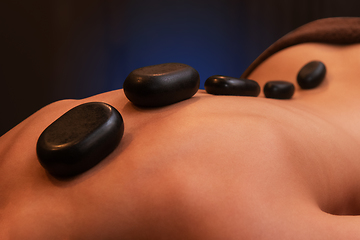 Image showing therapy with hot stones in spa center
