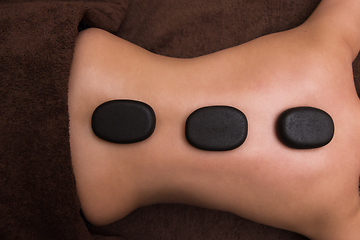 Image showing therapy with hot stones in spa center