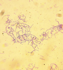 Image showing Microscope-Anthrax-Bacillus anthracis