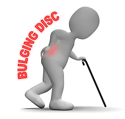 Image showing Bulging Disc Shows Back Chiropractor 3d Rendering