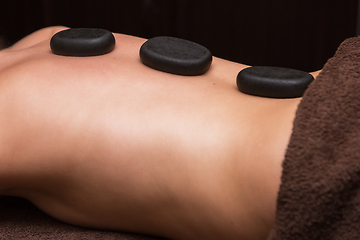 Image showing therapy with hot stones in spa center