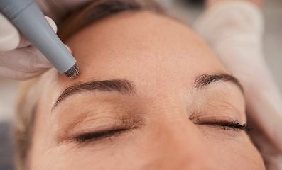 Image showing Microneedling, eyebrow and woman for beauty, skincare and cosmetics with collagen treatment or wellness. Customer, people or dermatology worker hands with microblading, hair or face permanent makeup