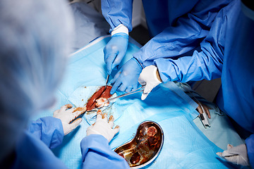 Image showing Emergency, hands or surgeons cutting in surgery or procedure or healthcare operation in hospital. Gloves closeup, medical tools or team of doctors helping in operating room with cotton or knife