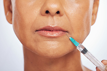 Image showing Lips, injection and face of woman for plastic surgery in studio, white background and skincare. Closeup of female model, cosmetics and syringe on mouth for dermatology, facelift and filler for beauty