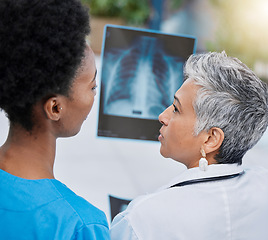 Image showing X ray, senior woman analysis and doctor team with conversation and medical collaboration. Healthcare, clinic and hospital worker with an xray doing problem solving with professional assessment