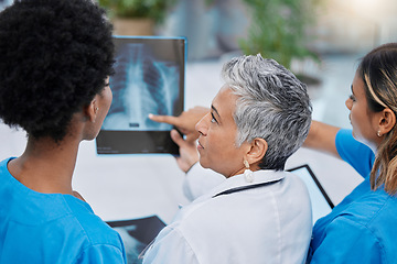 Image showing X ray, mri analysis and doctor team back with conversation and medical collaboration in a hospital. Healthcare, clinic and nurse worker with an xray doing problem solving with professional assessment