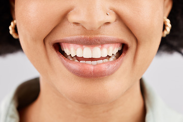 Image showing Smile, dental teeth and face of black woman in studio isolated on a white background. Tooth care, cosmetics and happiness of female model or person with lip makeup, gums and oral health for wellness