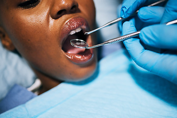 Image showing Mouth, woman and hands of dentist in dental surgery for clean teeth, denchers or oral hygiene at clinic. Female in tooth whitening treatment with tools for cleaning gum bacteria, disease or decay