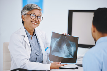 Image showing Happy, showing x ray and doctor with a man for medical advice, help and conversation. Radiology, healthcare and a mature woman holding a picture to show a patient results, research and hospital scan