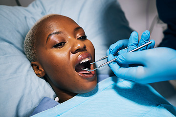 Image showing Healthcare, teeth and black woman with dental procedure, surgery and wellness in a hospital bed. Female person, lady and patient with medical equipment, recovery and check up with tooth whitening