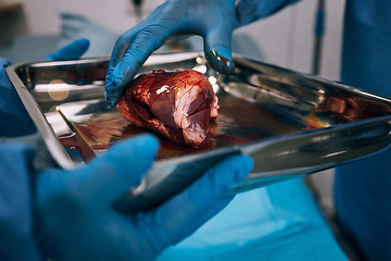 Image showing Hospital, doctor and organ transplant surgery in operating room with hands, healthcare and medical emergency. Blood, people hand and closeup of donor operation for healthy organs and surgeon at work